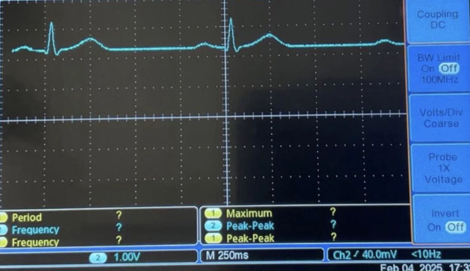 Human ECG captured by the sensing circuit during early testing, with P, QRS, and T waves clearly visible